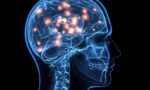 Классификация инфекционных заболеваний нервной системы
