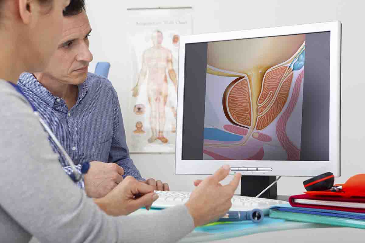 Диагностика и лечение аденомы простаты