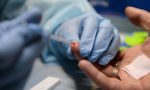 ВИЧ-инфекция: причины, диагностика, лечение