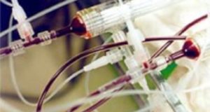 Четыре заблуждения о плазмаферезе